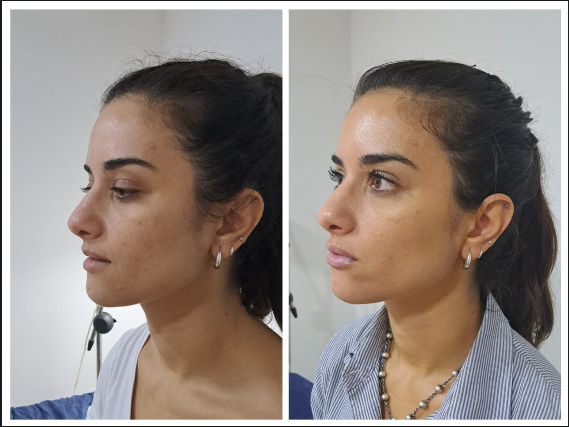 Tratamiento dermatológico