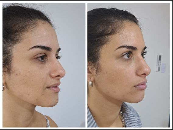 Tratamiento dermatológico