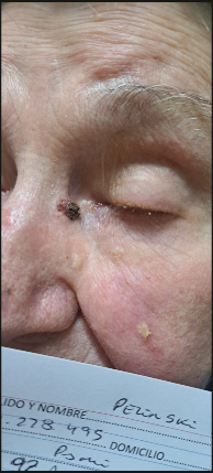 Tratamiento dermatológico
