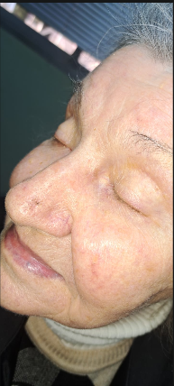 Tratamiento dermatológico